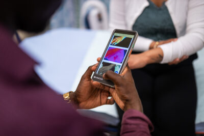 Close up photo of someone holding the MIMOSA Pro imaging device.